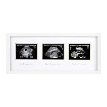 7.5x17 White Custom Triple Sonogram Pregnancy Frame Watch Baby Grow All Three Trimesters Great Gift for Expecting Parents